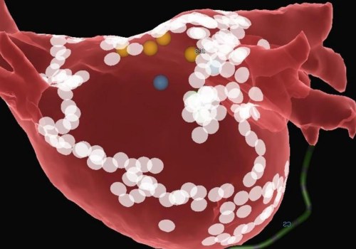 The Texas Heart Institute: Pioneering Cardiovascular Care
